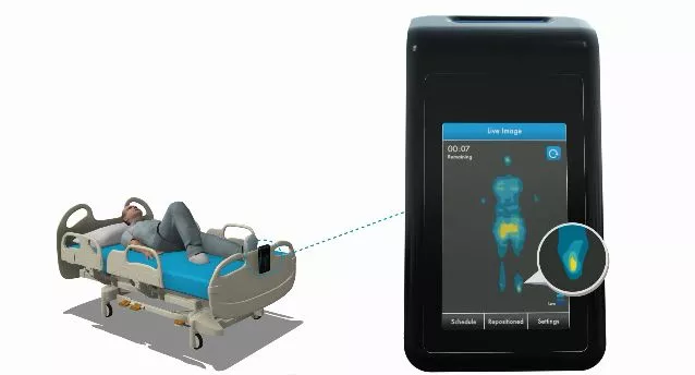 The MAP System provides a real-time display of the pressure points on a patient's body