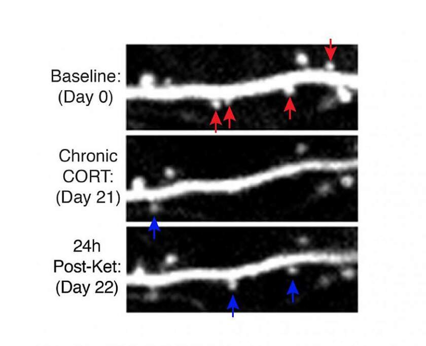 Images of dendritic spine remodeling, starting with the baseline, after exposure to a stressor, and after a single dose of ketamine