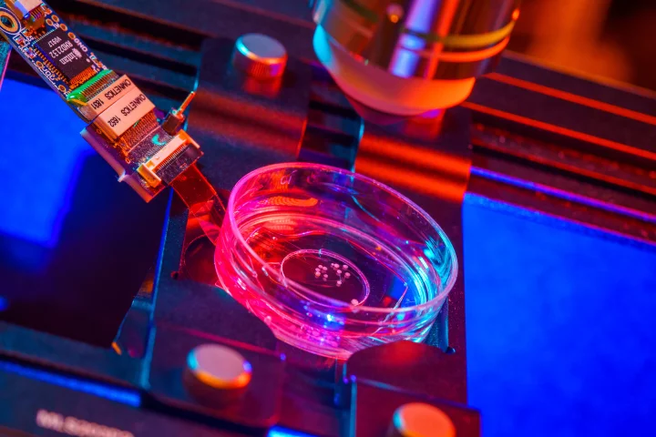 Tiny human brain "organoids" in a lab dish