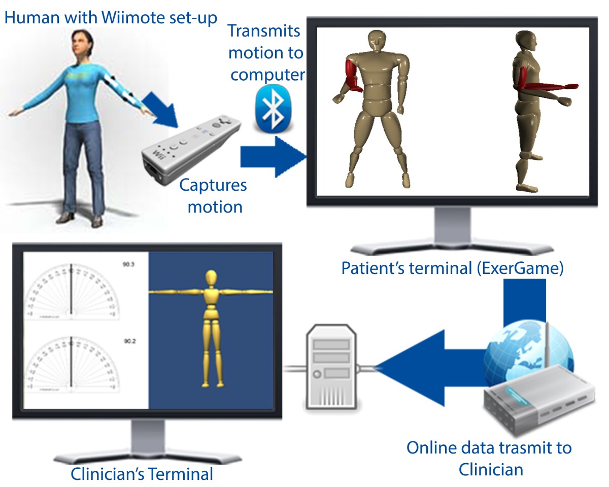 The Research in WiiRehabilitation system architecture (Image: Dr. Emmanuel Tsekleves)
