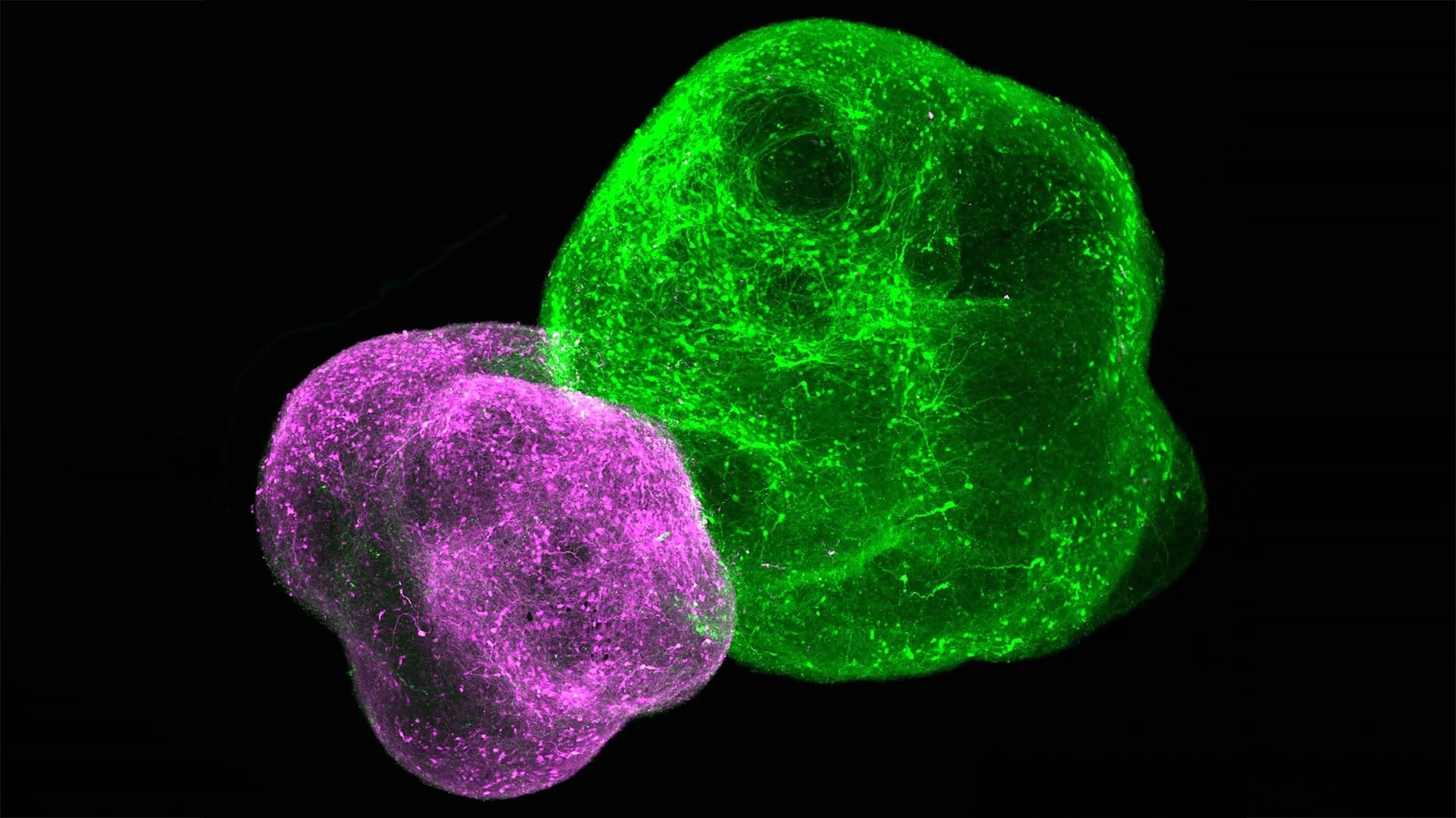 Tiny replicas of parts of the body's pain pathway unite into an assembloid, providing a way to better understand chronic pain