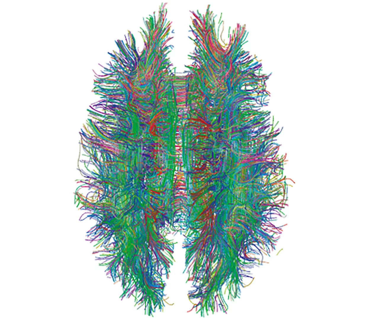 White matter tracts within a human brain, as visualized by MRI tractography