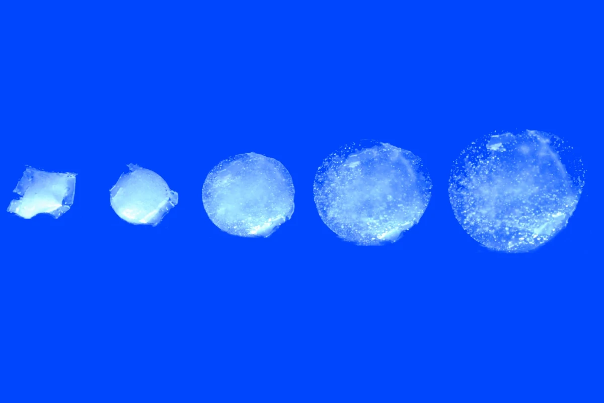 The pill has the potential to keep track of stomach health using a variety of sensors