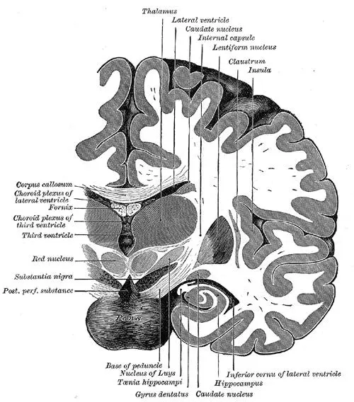 Cross section of brain showing the dentate gyrus ("Gyrus dentatus" at bottom center)
