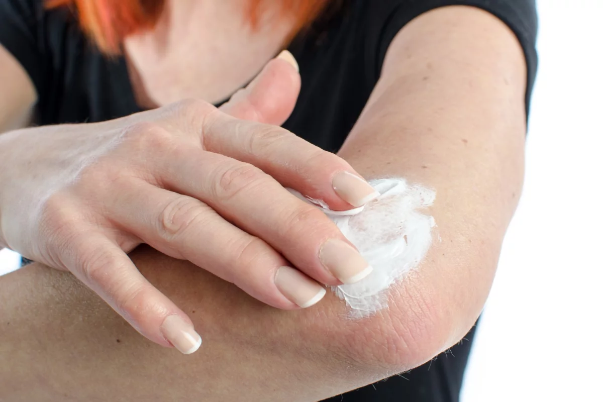 Researchers have made the first steps towards a chemotherapy gel that can be rubbed into the skin to treat melanoma