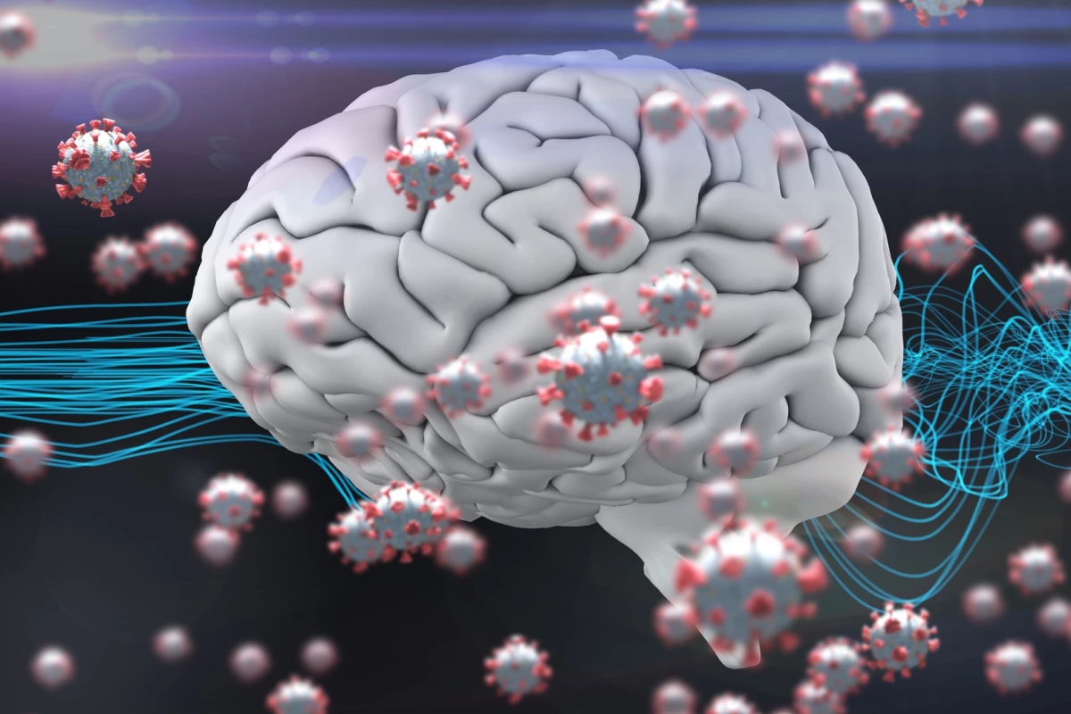 A new study has found distinct parallels between COVID-19 and Alzheimer's disease