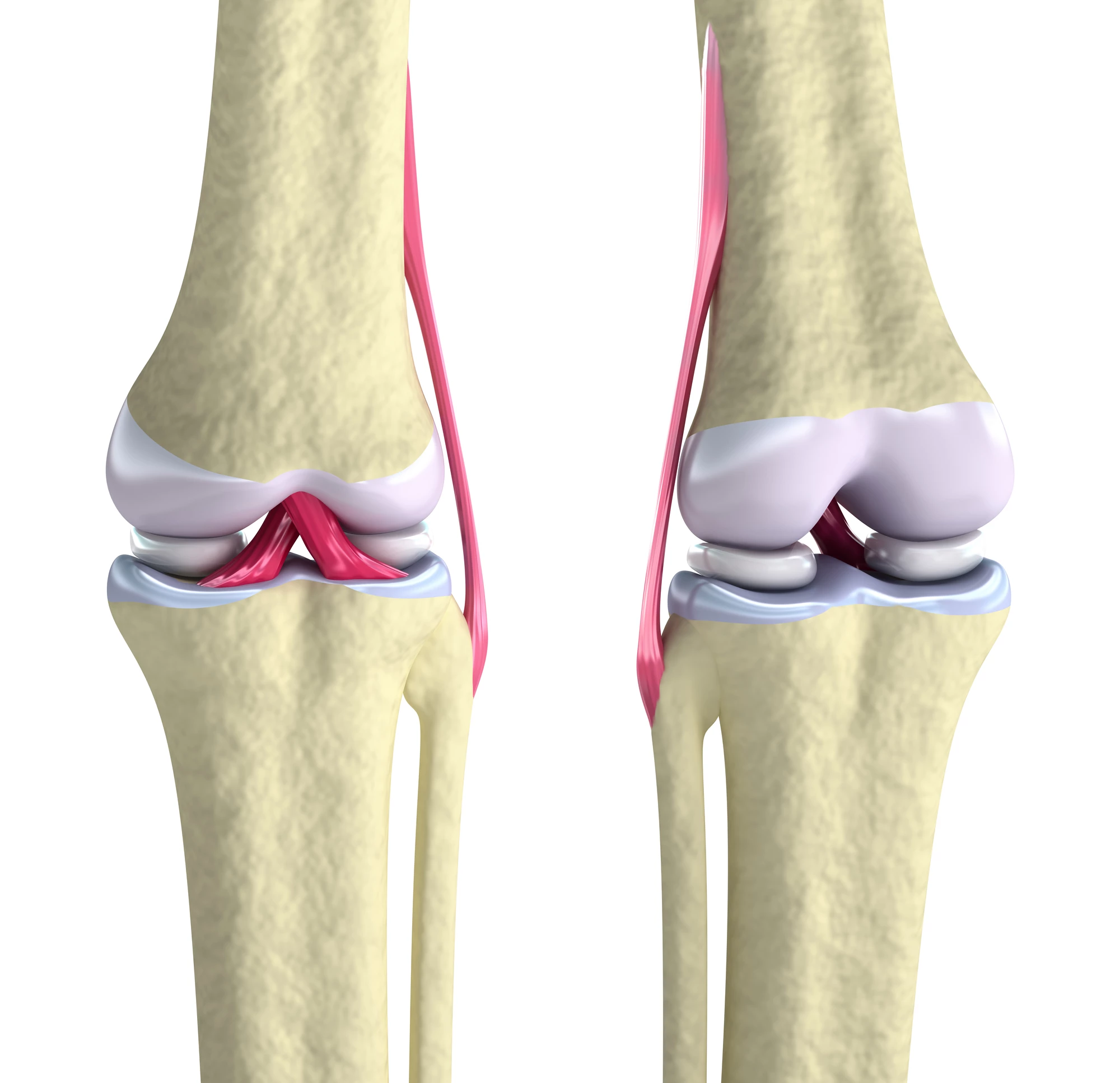 New hybrid bioinks could be used to 3D print replacement cartilage in the knee
