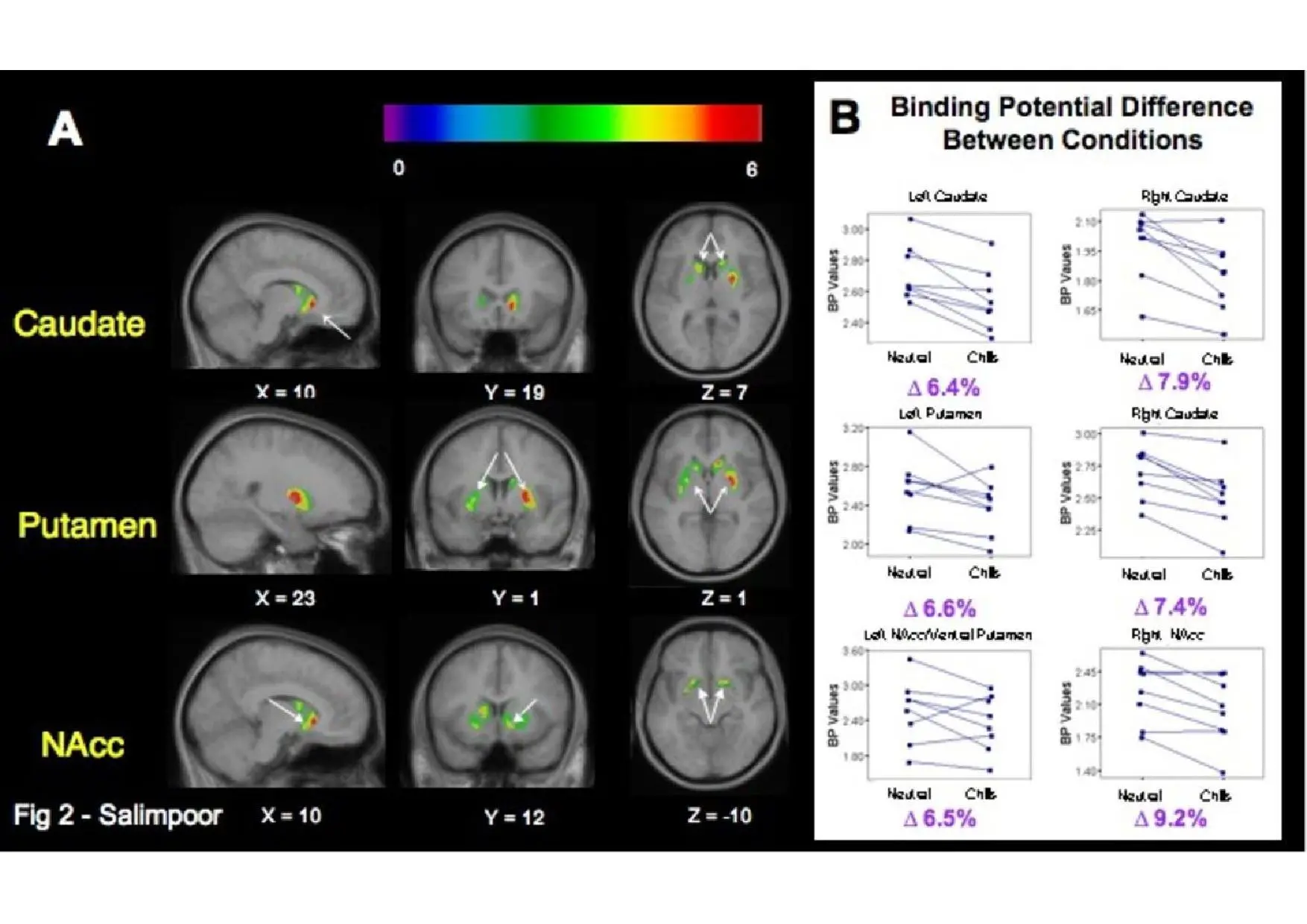 During each session, participants listened to either pleasurable or neutral music for 15 minutes before [11C]raclopride was injected, and continued to listen for an additional 60 minutes while PET frames were acquired
