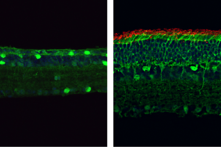The image on the left shows a lack of rod photoreceptors due to retinitis pigmentosa – the image on the right shows a thicker retina with more rod cells (shown in red) after a genetic mutation was corrected with a new gene-editing system called PESpRY.