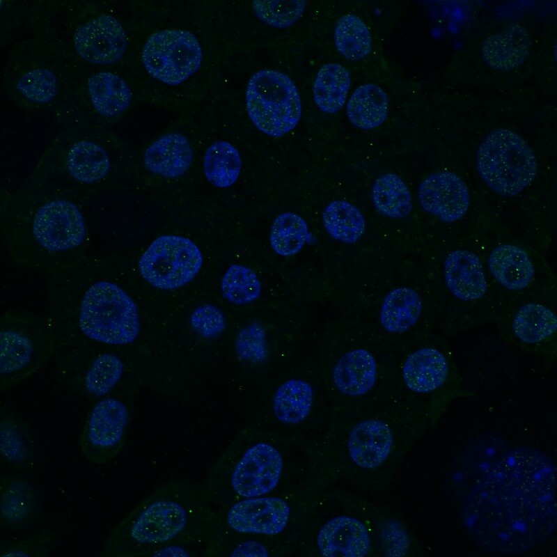 Equine induced pluripotent cells afterstaining with an antibody for NANOG (green), a protein that is present onlyin pluripotent cells (Image: University of Montreal)