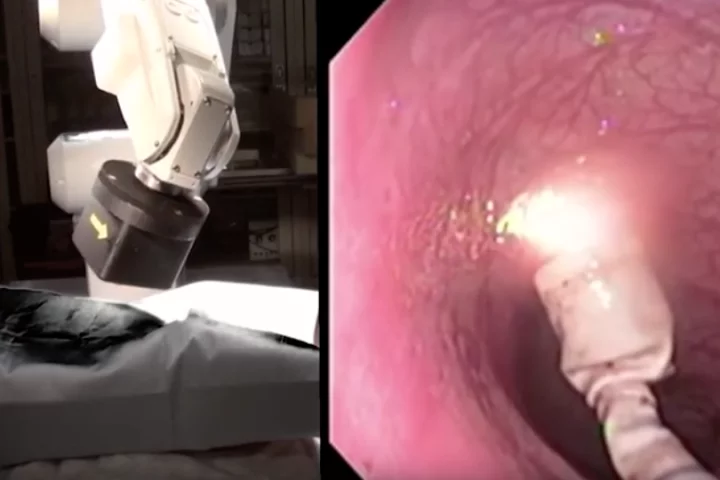 The capsule on the right is directed by a robotically controlled magnetic arm, as seen on the left