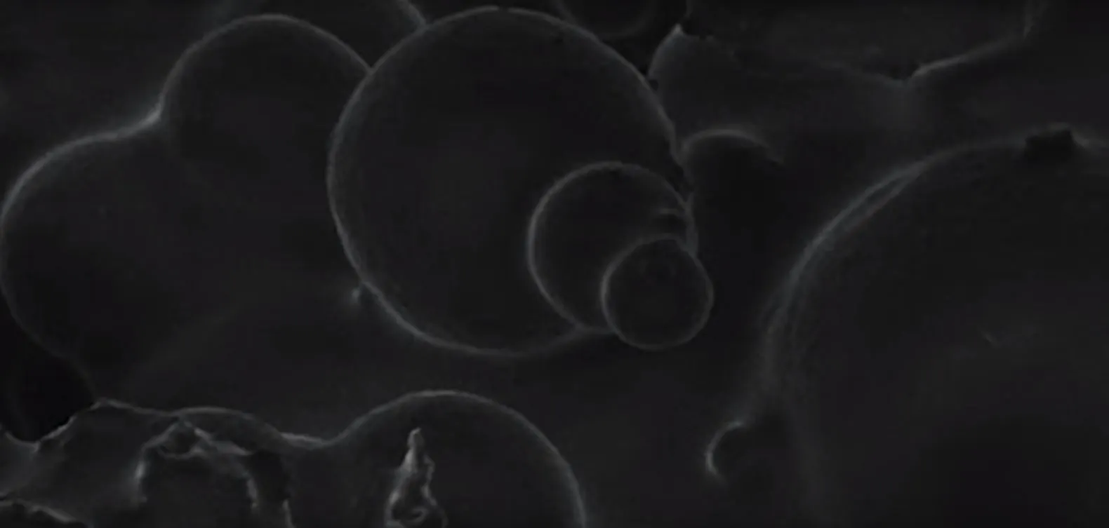 Electron microscope view of the SAC showing the spherical matrix