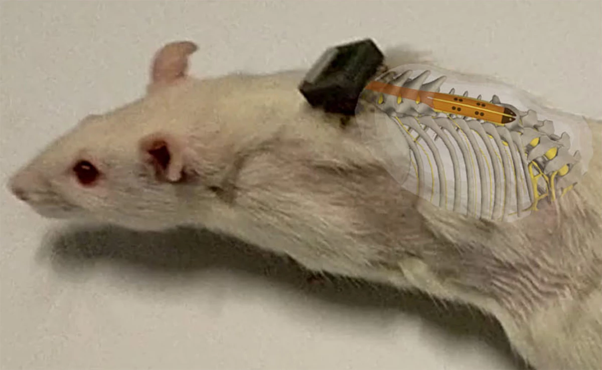 A visualization of the spinal cord implant embedded subdurally in a rat