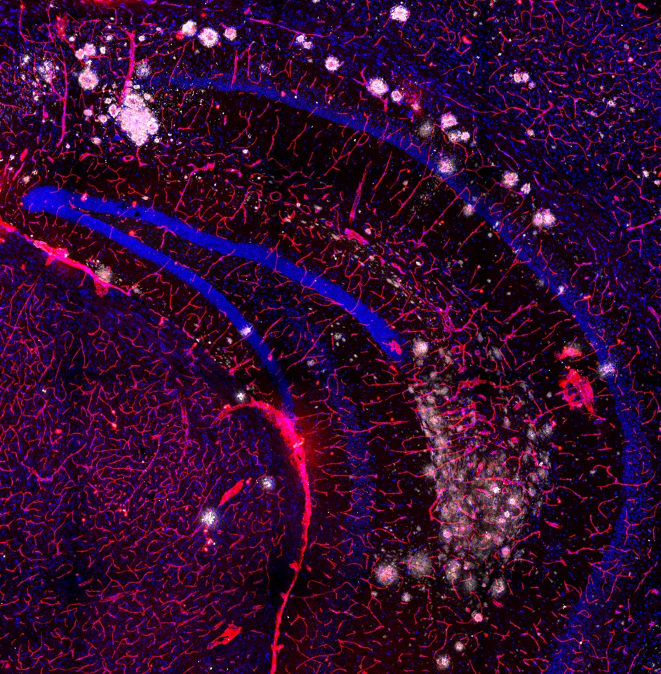 The winning entrant, "Cloudy Brain with a Chance of Forgetfulness," shows pathological amyloid plaques in a mouse brain