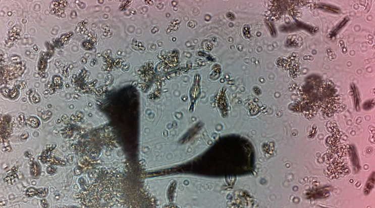 IBM Research scientists have developed a way to monitor the health and behavior of plankton, to get an understanding of the overall health of a water system