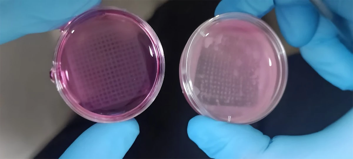 3D-printed structures with human keratinocytes up close; these can develop into skin tissue in two-three weeks