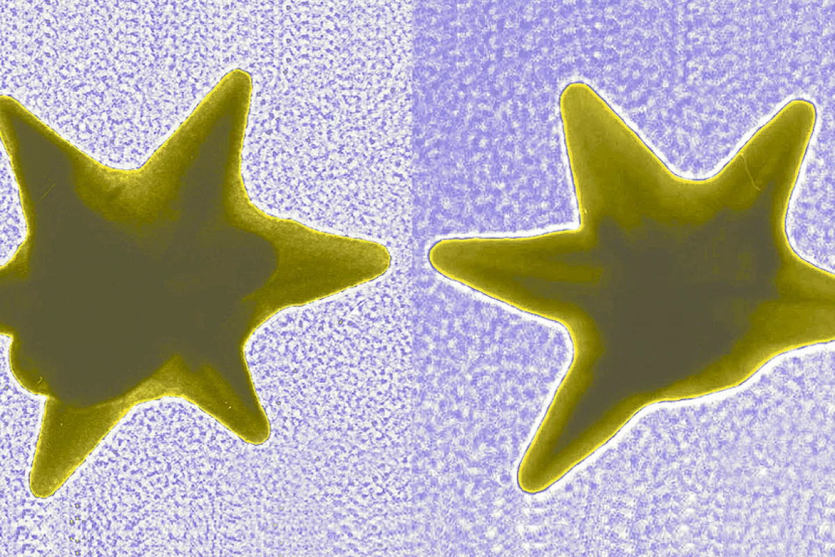 Gold nanostars like these are able to deliver drugs directly into the nucleus of cancer cells (Image: NIST)