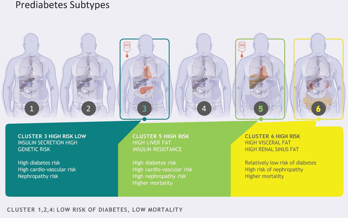 The research identified six distinguishable prediabetes subtypes, or clusters