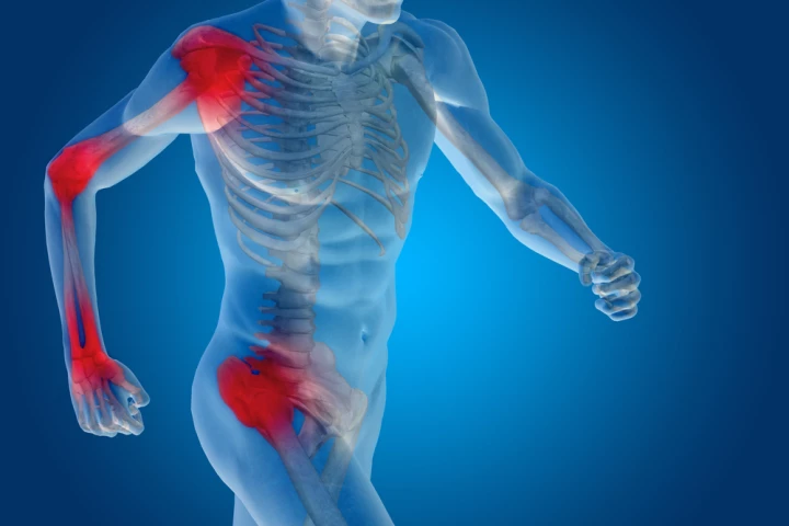 The newly identified molecule could hold the key to improved treatments for a variety of inflammatory diseases (Shutterstock)