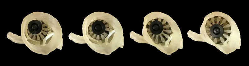 The sizer device developed by scientists to help determine the correct size for artificial heart valves ahead of implantation
