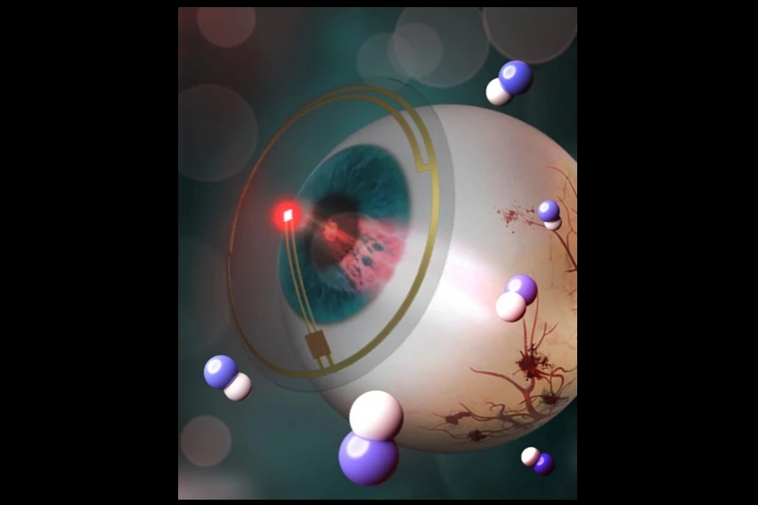 A rendering of the prototype, as applied to an eye