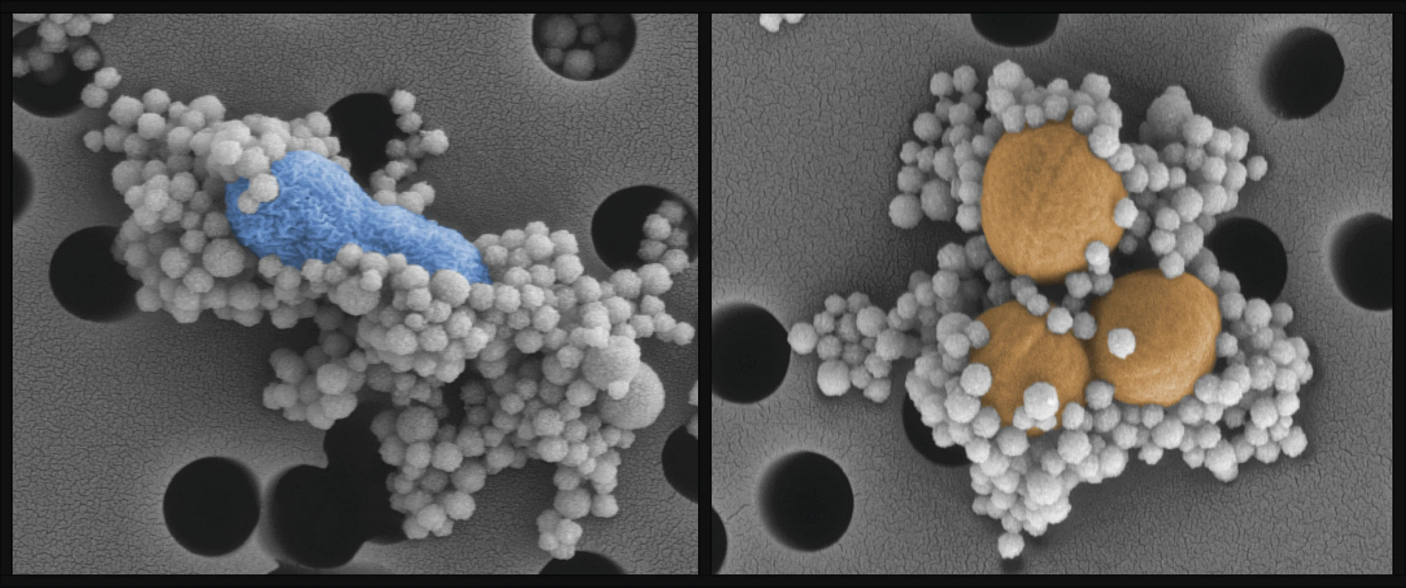 Sepsis microbes and toxins (blue and orange) stick to the protein-covered beads (white) (Image: DARPA)