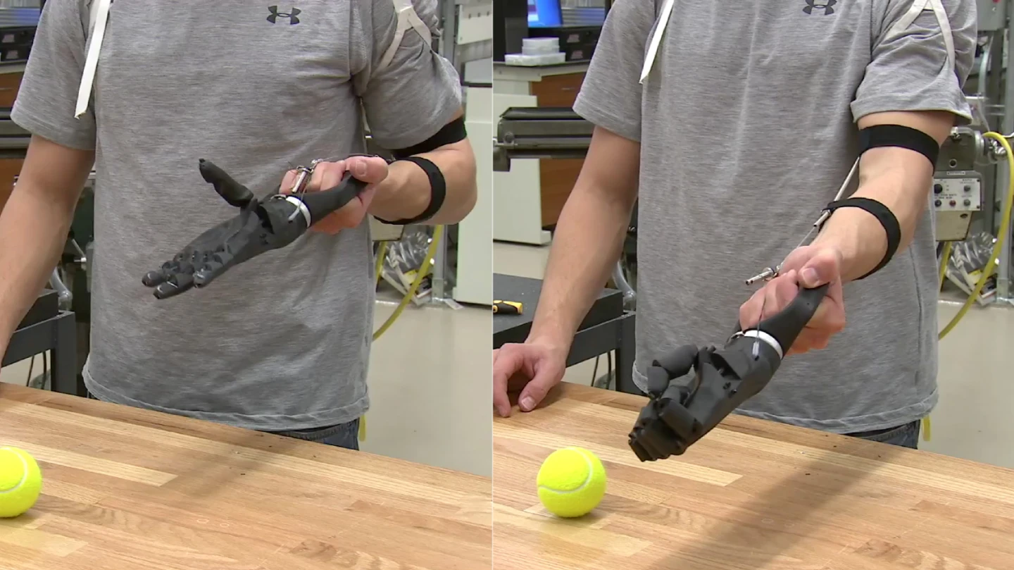 Eric Ronning's ReHand, made mostly out of parts fabricated by a 3D printer, costs just US$20 dollars in materials