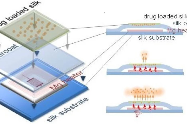 A diagram illustrating the makeup of the implants