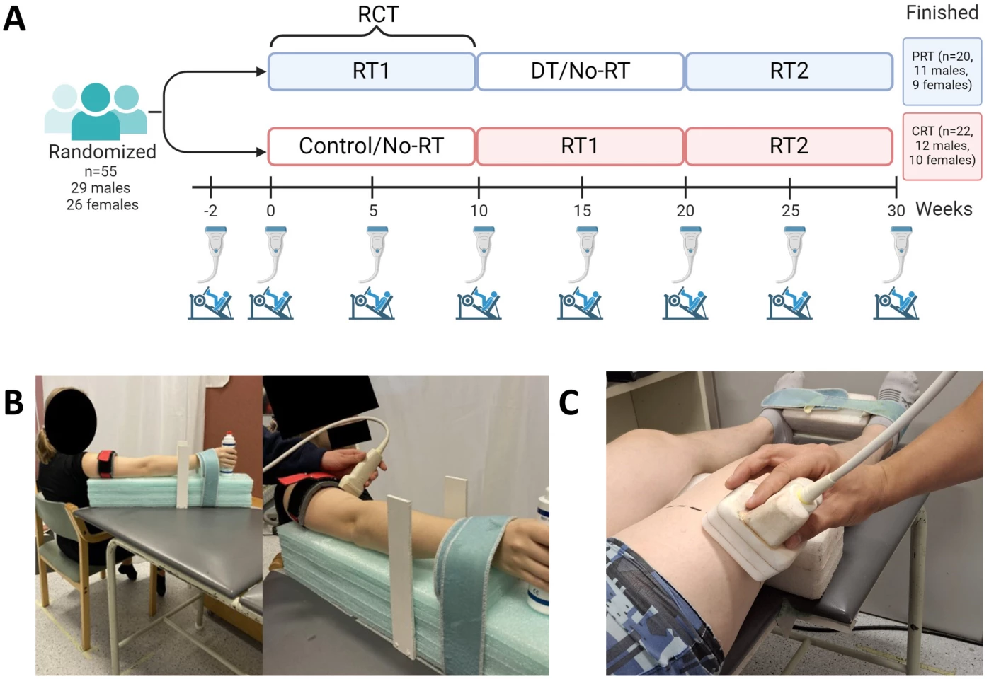The experiment's design (A): The ultrasound probe and leg-press icons represent muscle size and strength measurement time points. CSA assessment of the (B) biceps brachii muscle and (C) vastus lateralis muscle with axial plane ultrasound. (Image C was taken only for illustrative purposes.)