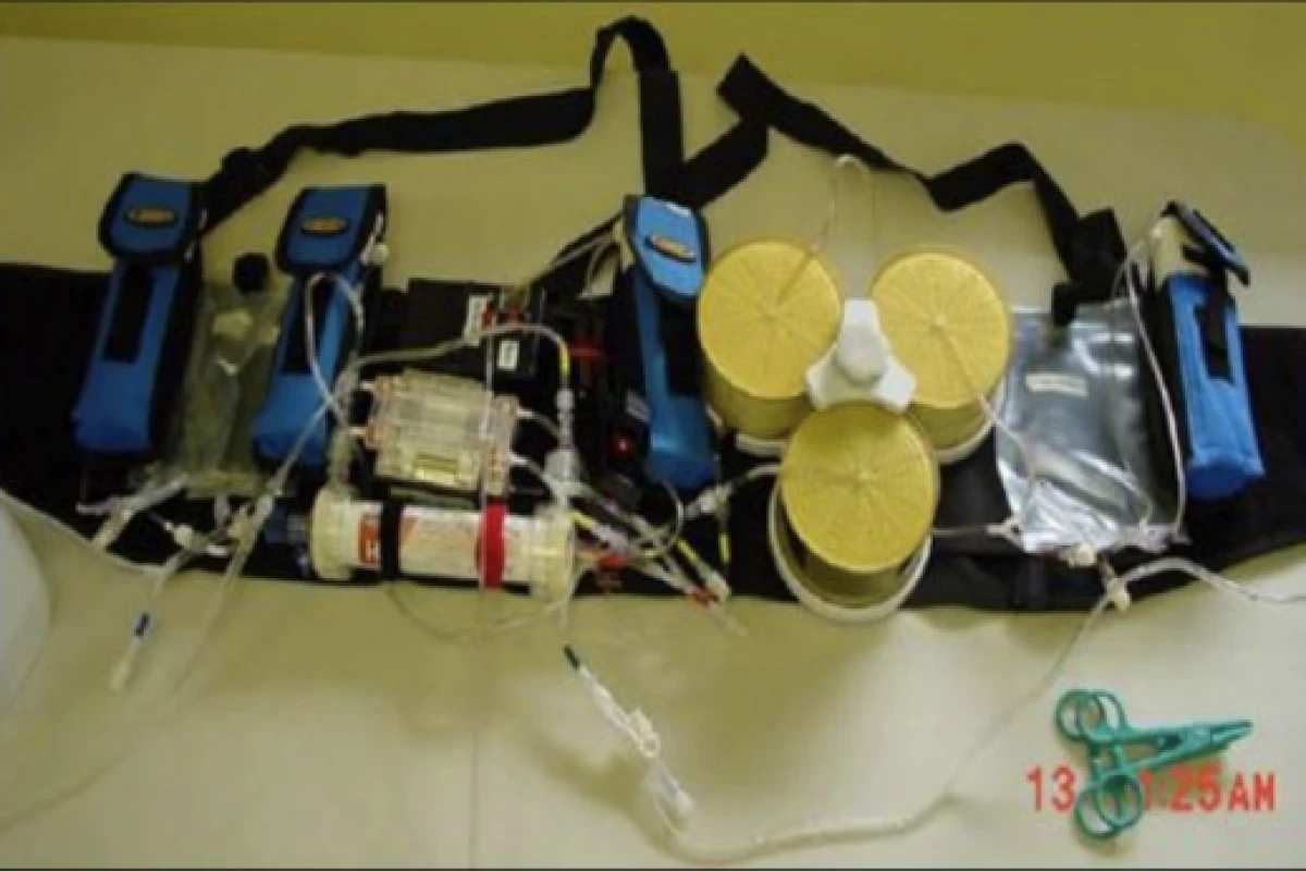 Wearable Artificial Kidney prototype