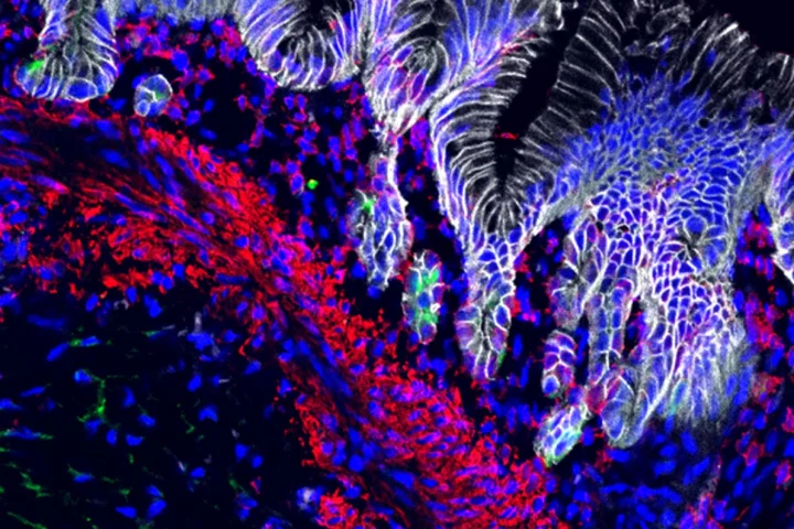 A 14-week-old stomach organoid, stained with different colors for different cell types