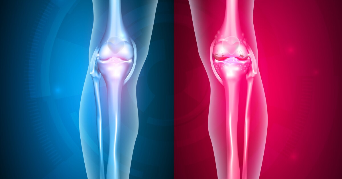 Liquid metal gives joint implants infection-fighting powers