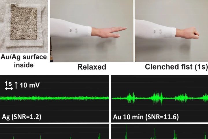 A compression sleeve incorporating conductive patches is used to measure the muscle activity in a wearer's forearm as they form a fist