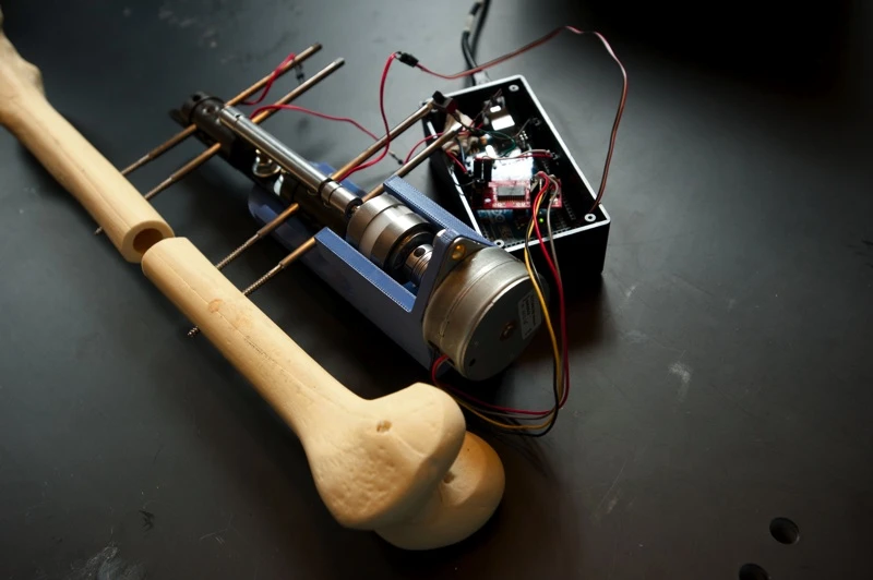 Students create automated bone-lengthening device