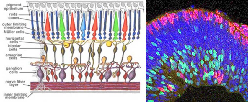 The left image is a schematic of the human retina, and on the right is a photomicrograph of the lab-grown retina (Images: State University of New York Downstate Medical Center/ University of Wisconsin-Madison)