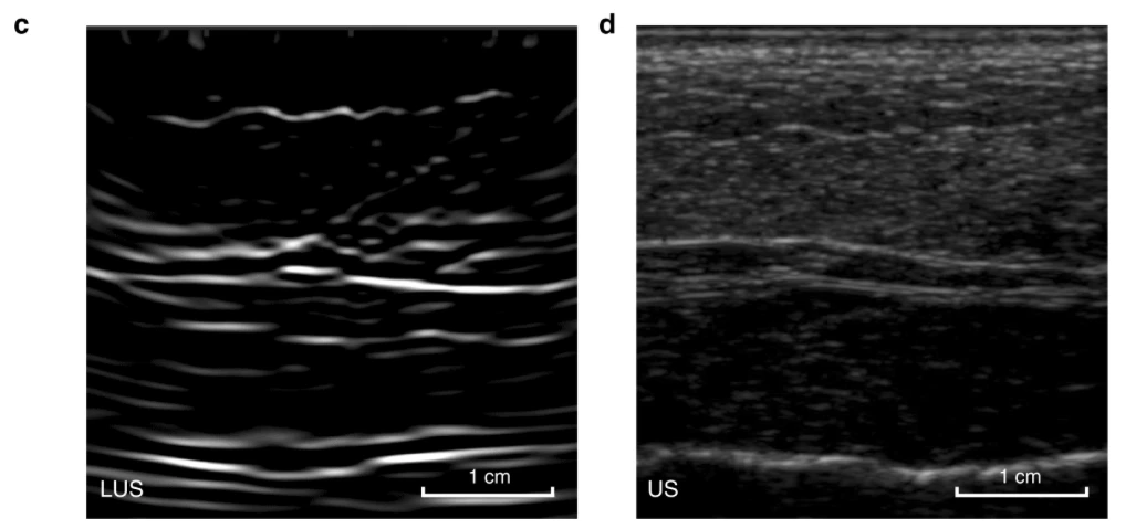 An image slice of porcine tissue. Laser ultrasound on the left, traditional ultrasound on the right