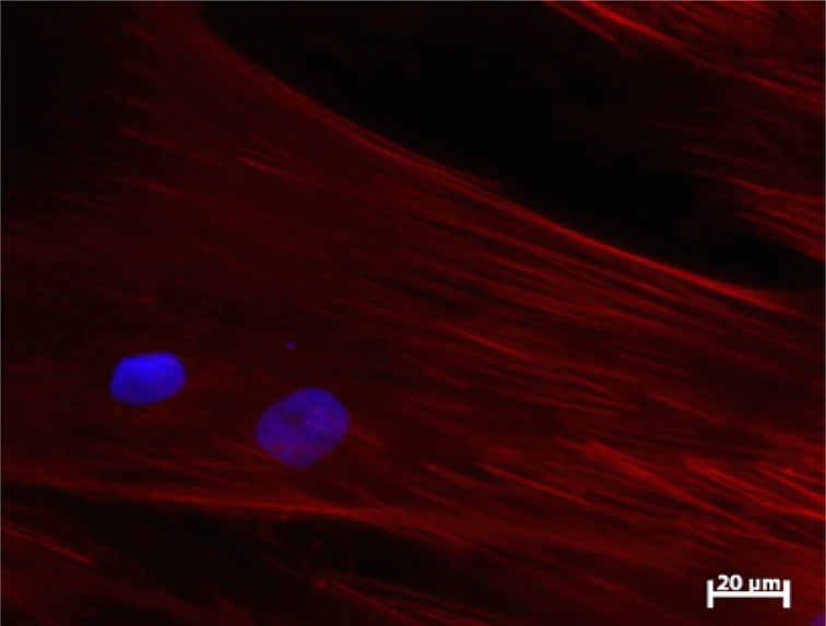Adult stem cells that are no longer functioning