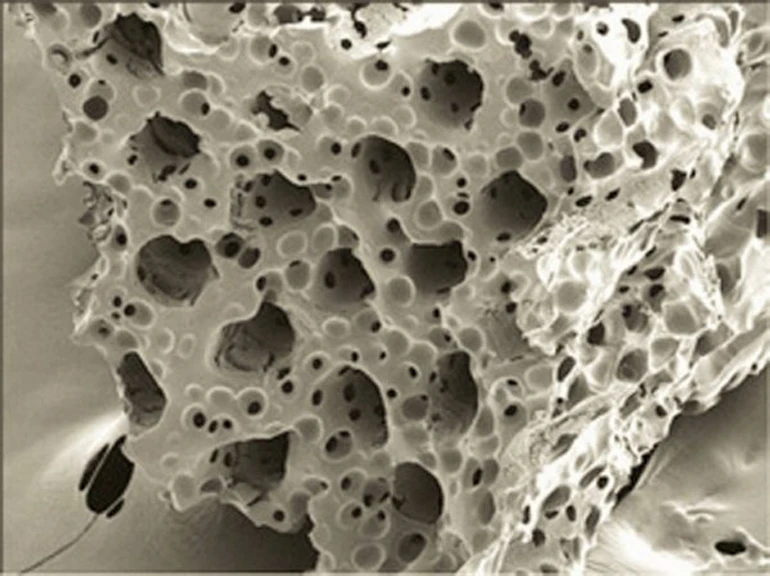 The scaffold is built out of a flexible, biocompatible material with pores that support the fragile cardiac cells and allow access to blood and nutrients (UW)
