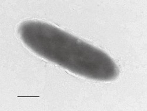The new bacteria were found to degrade hydrocarbons