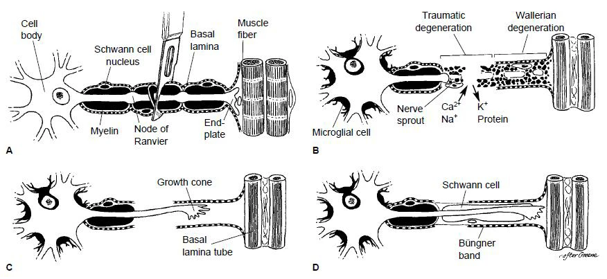 Death and regeneration of a nerve fiber (Image: John Wiley and Sons)