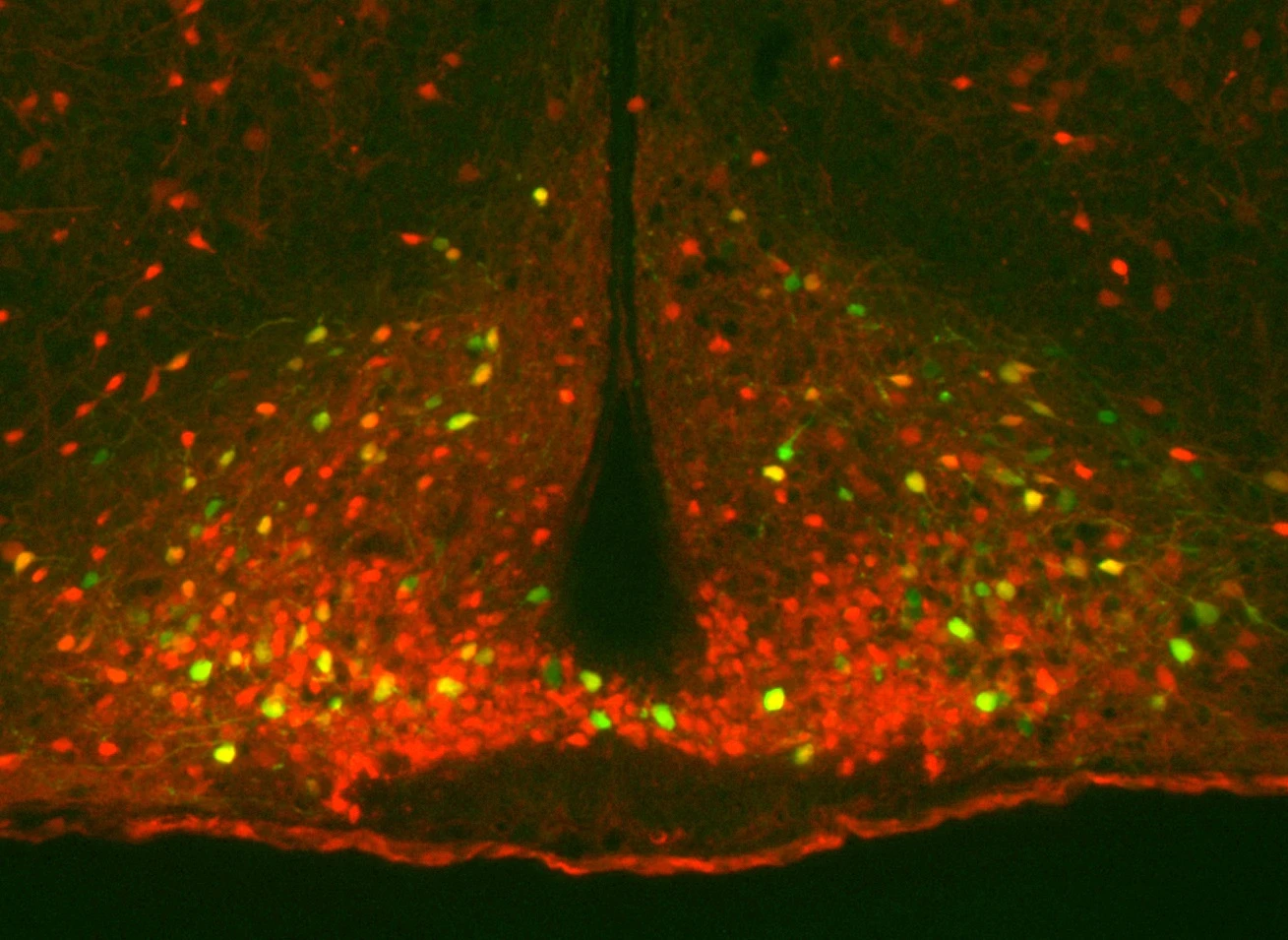 In a mouse study, important neurons that regulate metabolism (shown in green and yellow) were found to activate for up to two days after a single exercise workout