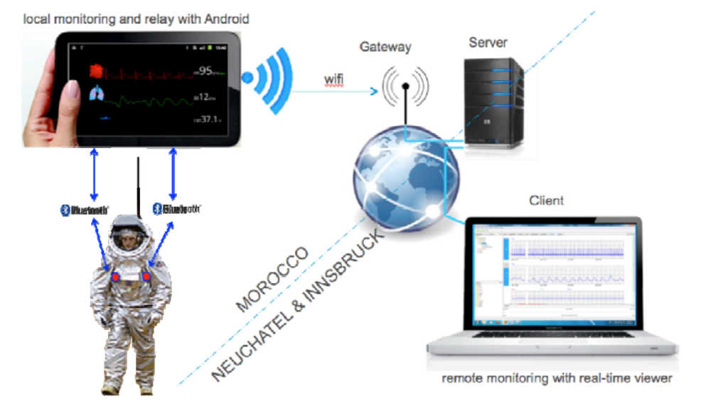 Long-term medical monitoring system LTSM (Image: CSEM)