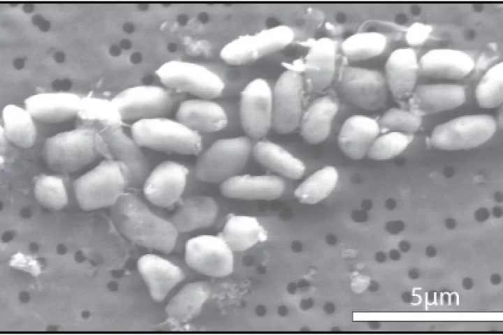 The GFAJ-1 bacteria, grown on arsenic
