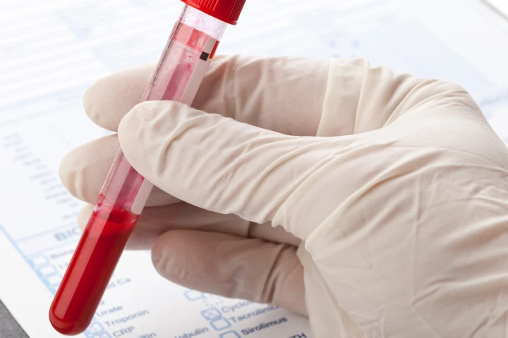 Research suggests a blood test to detect depression is possible (Photo: Shutterstock)