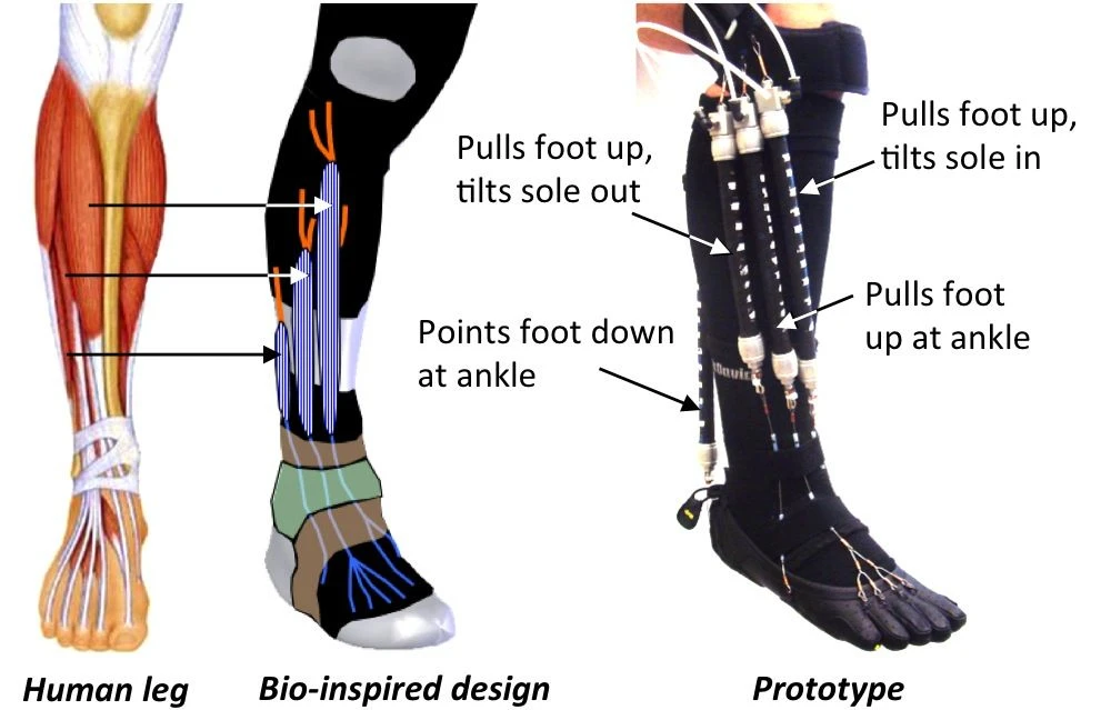 A diagram of the experimental orthotic device