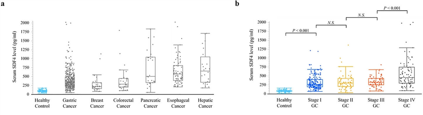 SDF4 levels in healthy controls and patients with various cancers, and in progressive stages of gastric cancer