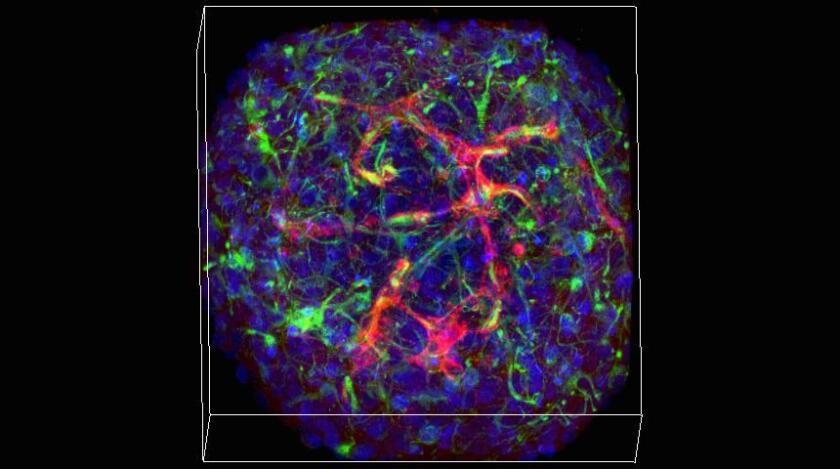 The mini-brain's vasculature network is visible under a microscope, thanks to a staining process