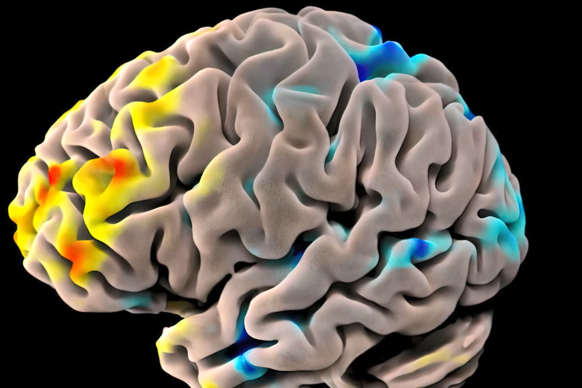 The research looked at 40 years of clinical trials investigating the effects of noradrenergic drugs on Alzheimer’s disease symptoms