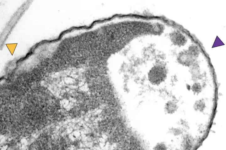 A Klebsiella pneumoniae bacteria after being attacked by the molecular drills. The yellow arrows indicate cell wall holes, and the purple shows where material is leaking from inside