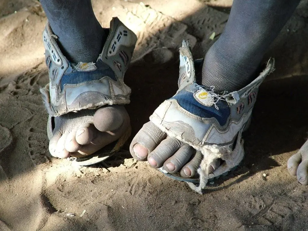 Children living in poverty often have to make do with shoes that are too small for them